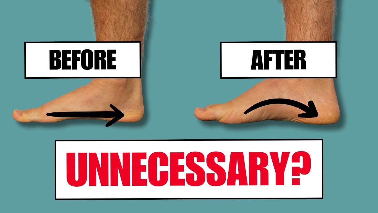 Are Flat Feet Exercises a waste of time? (scientific analysis)
