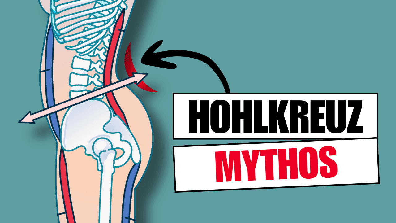 Rückenschmerzen durch Hohlkreuz Das ist ein Mythos!