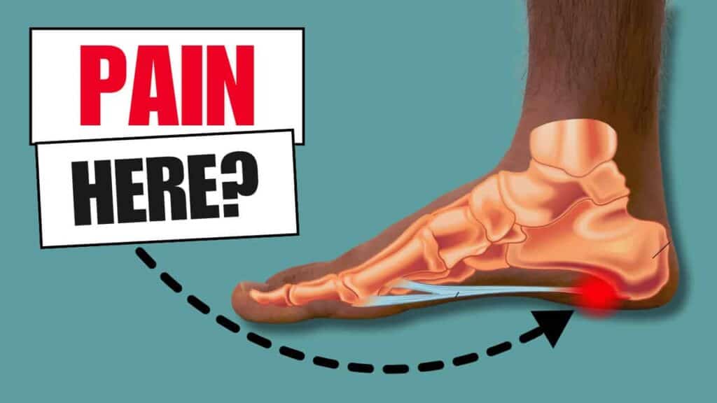 How to fix Plantar Fasciitis
