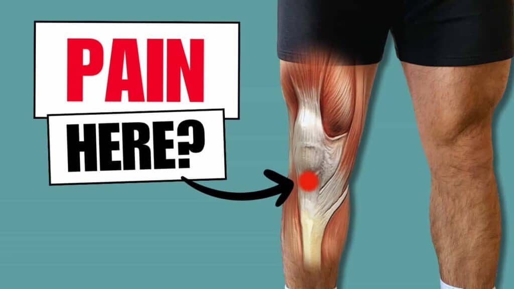 Patellar Tendonitis Diagnosis, Exercises and Myths
