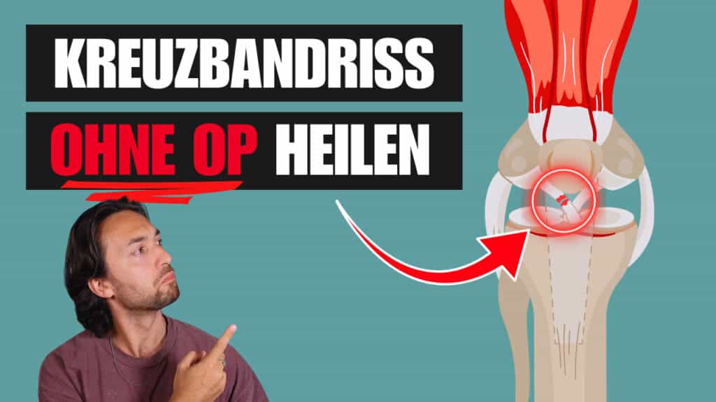 Kreuzbandriss OHNE OP heilen und OP ja oder nein