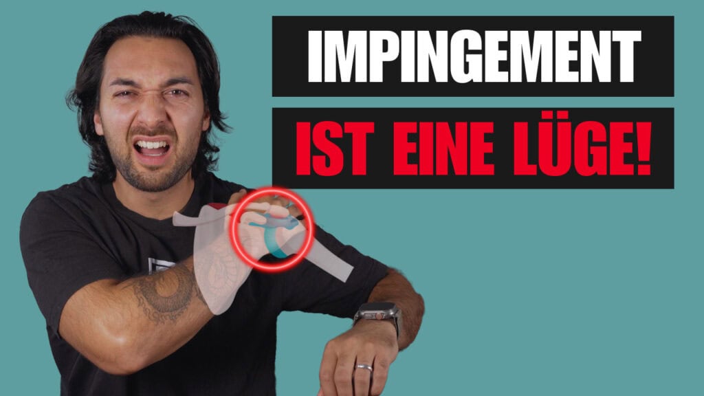 Impingement Syndrom Schulter