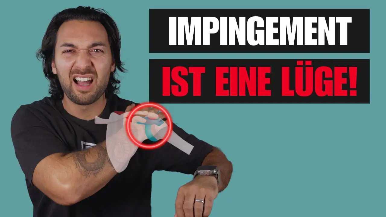 Impingement Syndrom Schulter