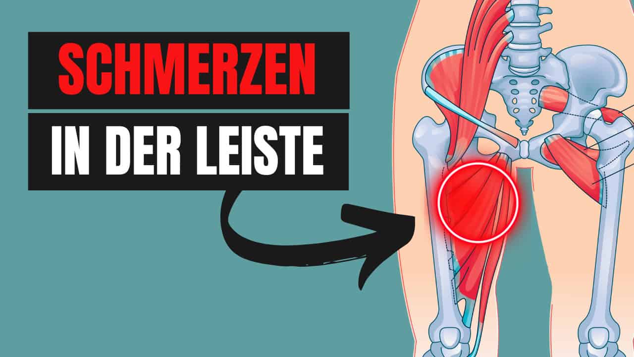 Schmerzen in der Leiste